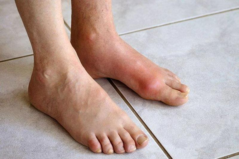 Các bệnh về xương khớp