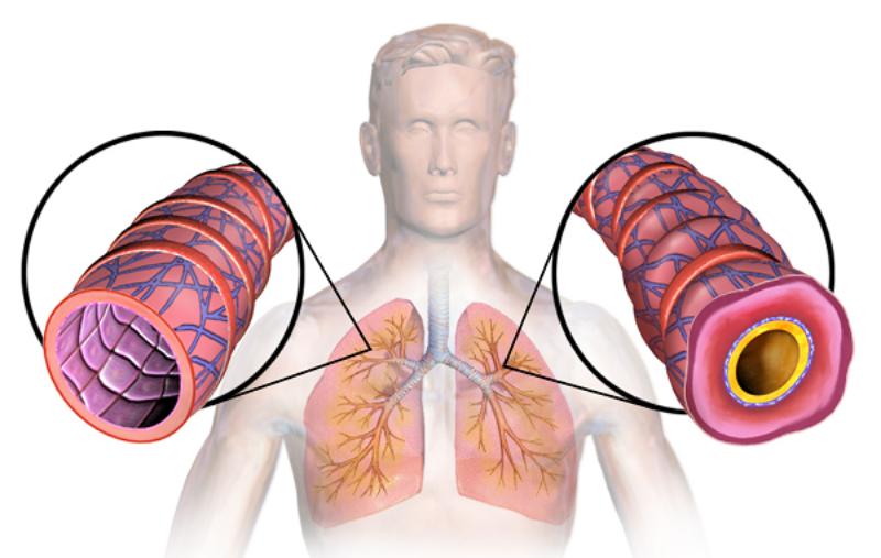 Các bệnh về hô hấp